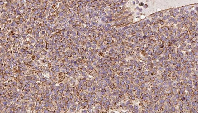 QCR2 / UQCRC2 Antibody