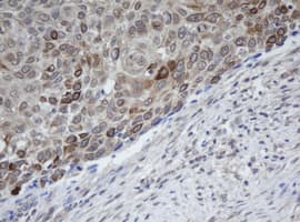 MAGEB1 Antibody (clone OTI2B12)