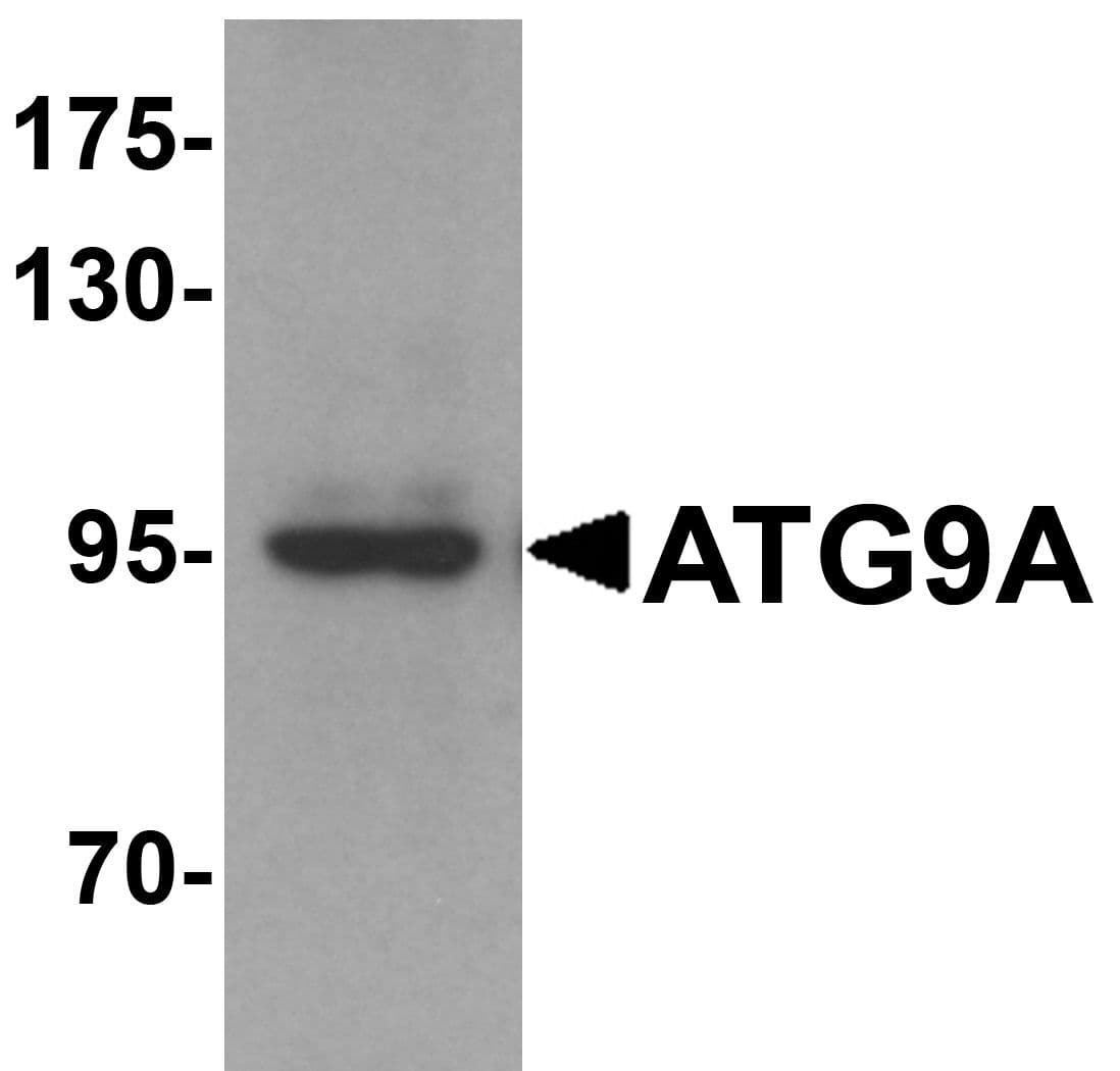 IHC-plus™ Polyclonal Rabbit anti-Human ATG9A Antibody (IHC, IF, WB)