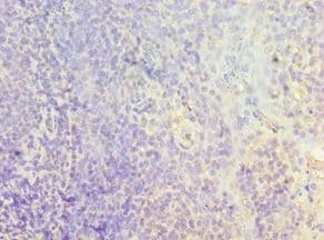 Polyclonal Rabbit anti-Human CMA1 / Mast Cell Chymase Antibody (aa1-247, IHC)