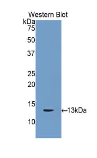 GJB3 / CX31 / Connexin 31 Antibody (aa7-102)
