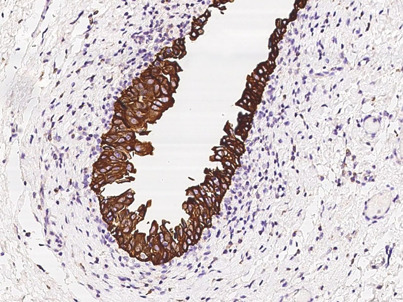 Polyclonal Rabbit anti-Human KRT17 / CK17 / Cytokeratin 17 Antibody (IHC, IF)