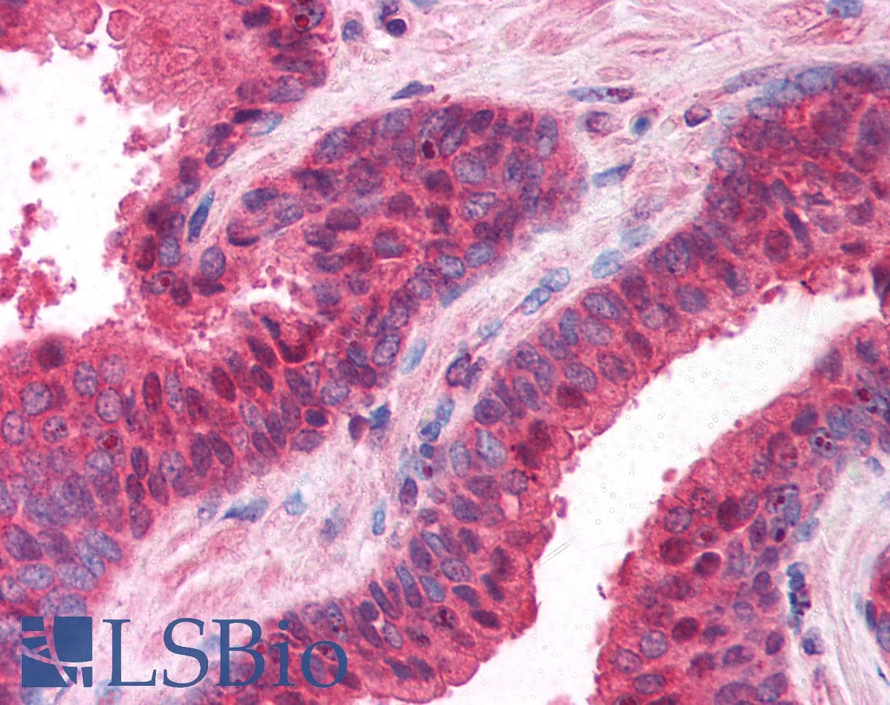 IHC-plus™ PPP4C Antibody (aa294-307)