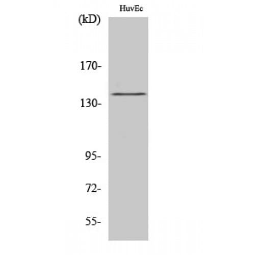 NOS3 / eNOS Antibody (1110-1190 aa)