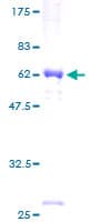 Human SRGAP3 Protein (Recombinant GST)
