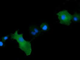 MAP2K1 / MKK1 / MEK1 Antibody (clone OTI8A6, Carrier-free)