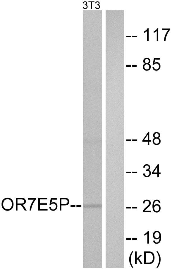 Polyclonal Rabbit anti-Human OR7E5P Antibody (IF, WB)