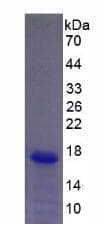 Mouse NGB / Neuroglobin Protein (Recombinant His, N-Terminal)