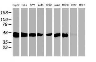 IHC-plus™ SEC14L2 Antibody (clone 4H2)