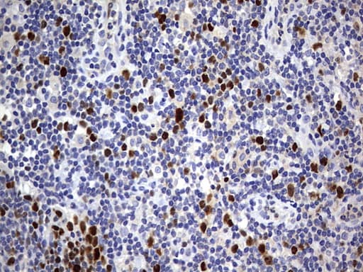 Monoclonal Mouse anti-Human TOP2A / Topoisomerase II Alpha Antibody (clone OTI1B10, aa1100-1531, IHC, WB)