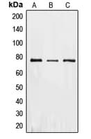 EIF2AK2 / PKR Antibody (C-Terminus)