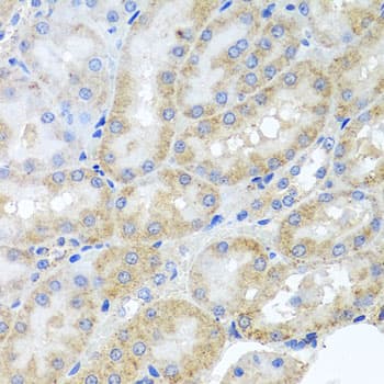 Polyclonal Rabbit anti-Human PEX3 Antibody (IHC, WB)