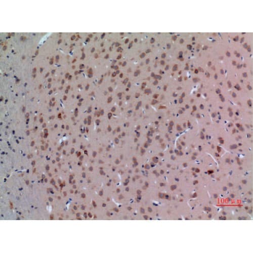 Polyclonal Rabbit anti-Human ABL2 Antibody (591-640 aa, Internal, IHC, WB)