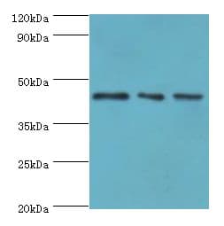 Polyclonal Rabbit anti-Human YKL39 / CHI3L2 Antibody (aa27-390, IHC, WB)