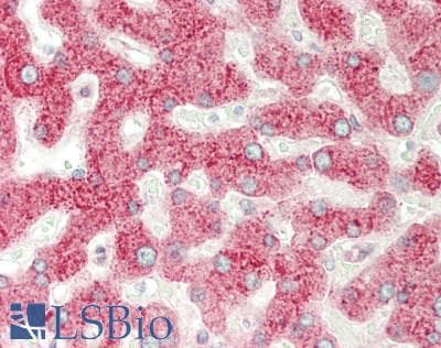 IHC-plus™ Polyclonal Rabbit anti-Human MBL2 / Mannose Binding Protein Antibody (IHC, WB)