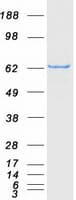 Human ACSM5 / MACS3 Protein (Recombinant Myc-DDK (Flag))