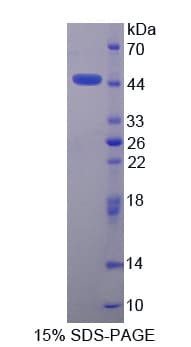 Human PRM2 / Protamine 2 Protein (Recombinant His-GST-S)