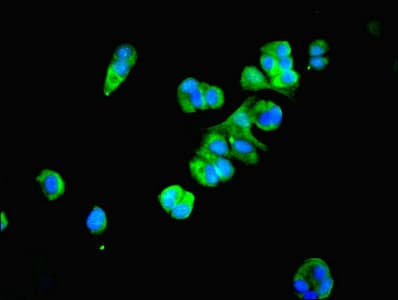 PSMB4 Antibody