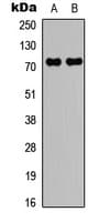 RAF1 / RAF Antibody (N-Terminus)