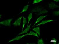 Monoclonal Mouse anti-Human CARD8 / Cardinal / TUCAN Antibody (clone 2108C2a, IF, WB)