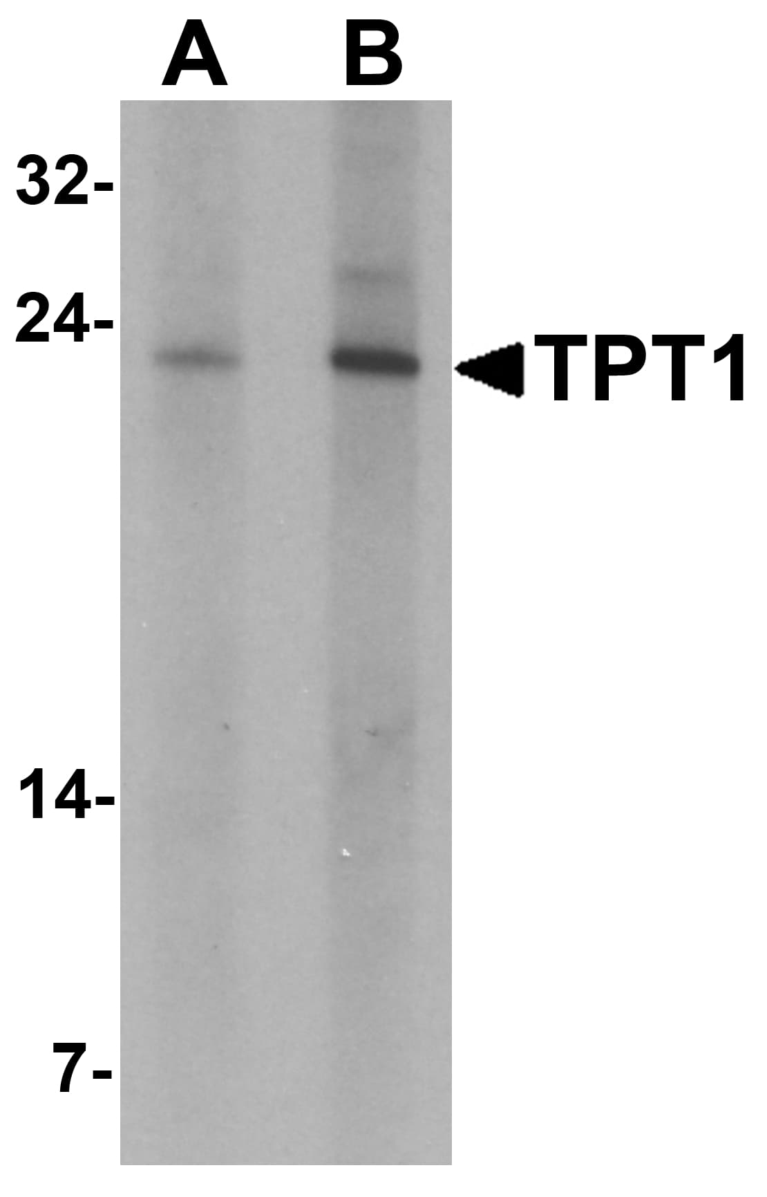 IHC-plus™ Polyclonal Rabbit anti-Human TPT1 / TCTP Antibody (IHC, IF, WB)
