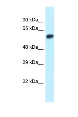 EEPD1 Antibody (N-Terminus)