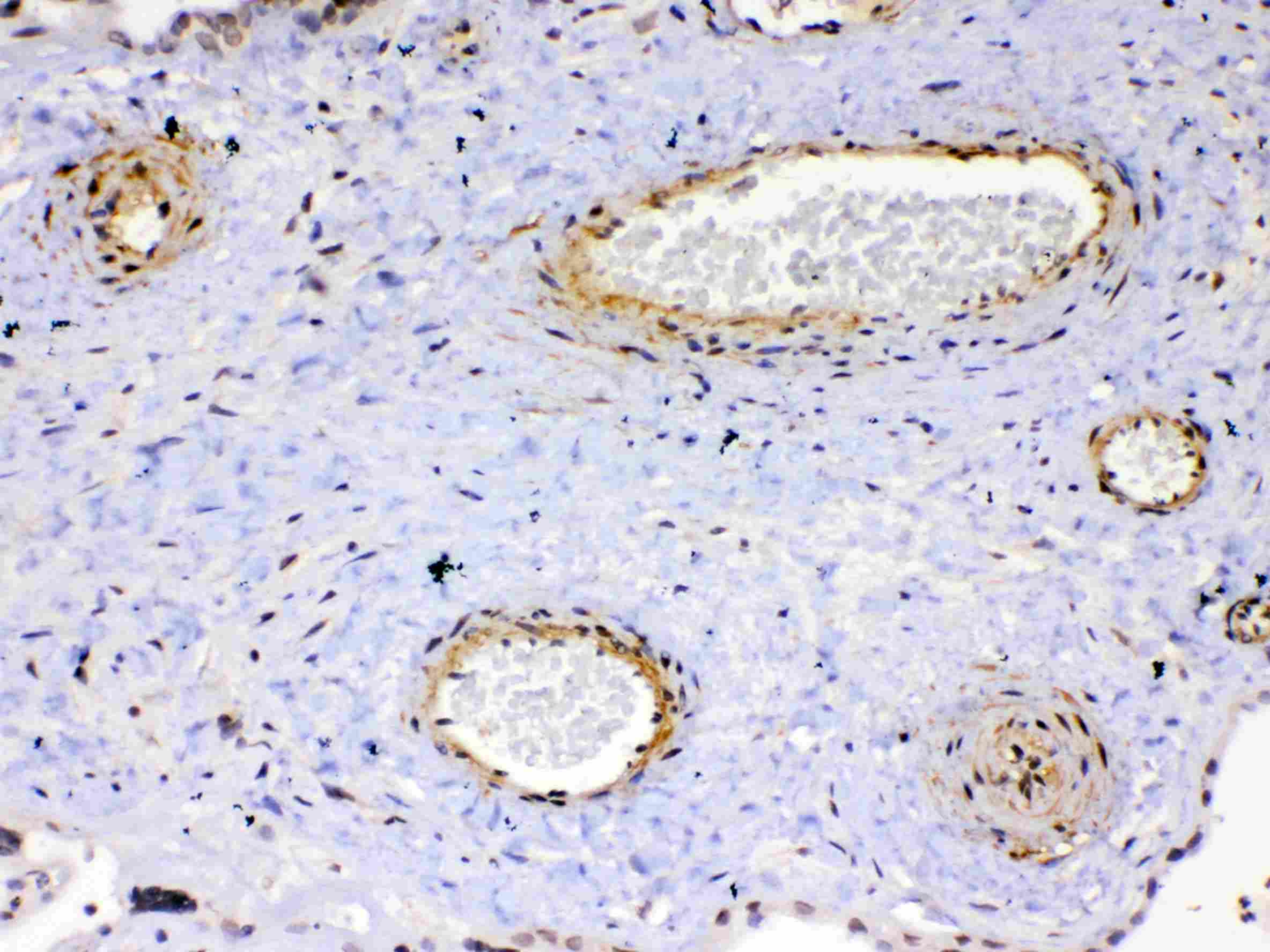 KDR / VEGFR2 / FLK1 Antibody