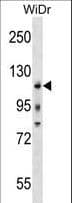 Polyclonal Rabbit anti-Human c-Kit / CD117 Antibody (aa547-577, WB)