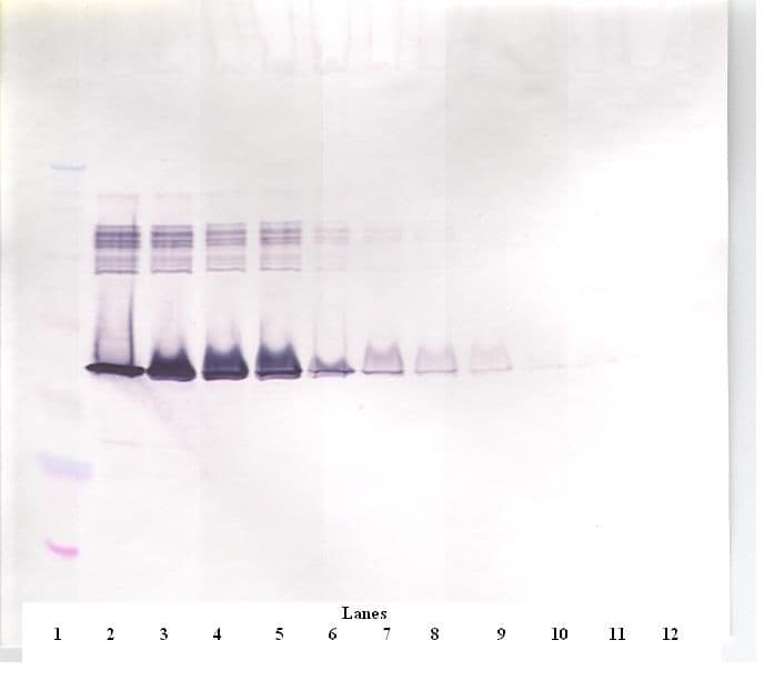IHC-plus™ SERPINE1 / PAI-1 Antibody