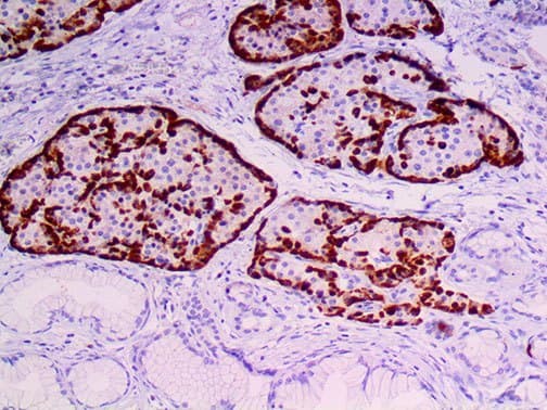 GCG / Glucagon Antibody
