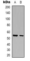 GLYCTK / Glycerate Kinase Antibody (Internal)