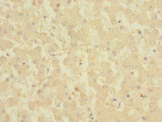 Polyclonal Rabbit anti-Human CRLF2 / TSLPR Antibody (IHC)