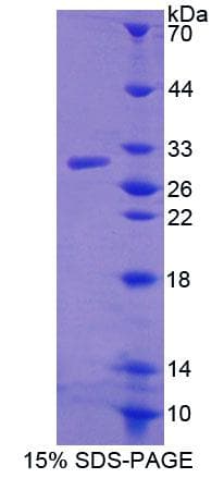 Mouse ABCD4 Protein (Recombinant His-T7, N-terminus)