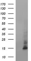 Monoclonal Mouse anti-Human MSMB / MSP Antibody (clone OTI20F2, WB)