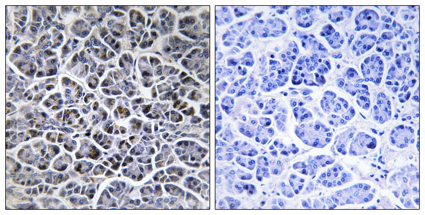 PPM1K Antibody (aa205-254)