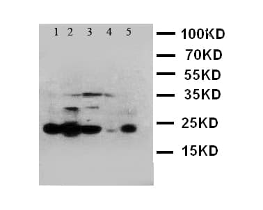 Polyclonal Rabbit anti-Human CASP4 / Caspase 4 Antibody (aa104-124, IHC, WB)