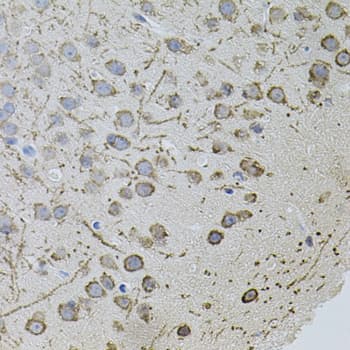 AR / Androgen Receptor Antibody