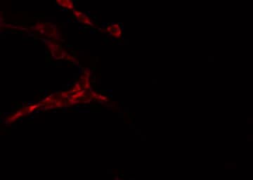 LMTK3 Antibody