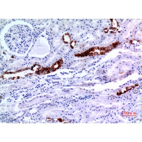 Polyclonal Rabbit anti-Human KRT8 / CK8 / Cytokeratin 8 Antibody (IHC, WB)