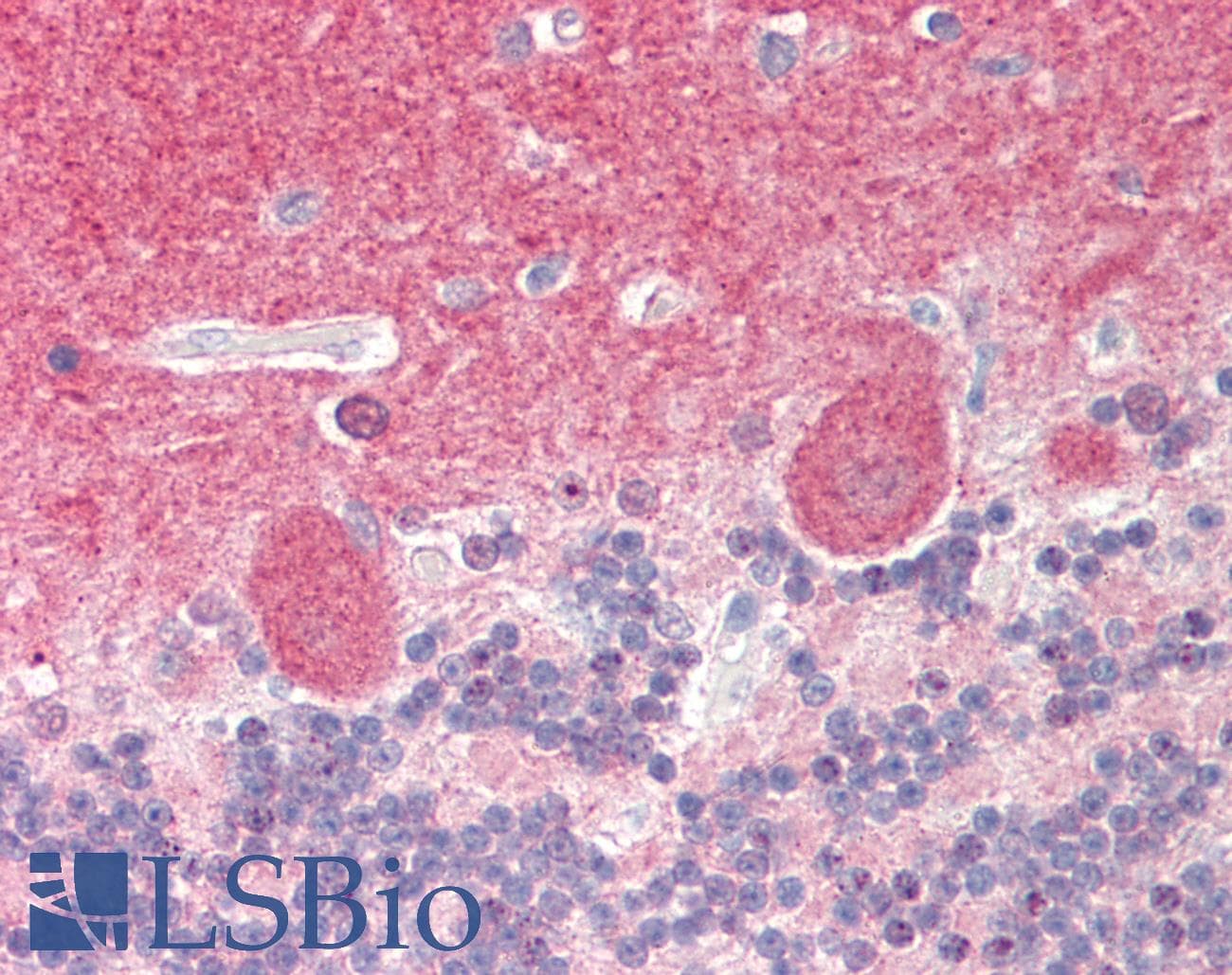 PPP3CA / CCN1 / Calcineurin A Antibody (aa432-481)