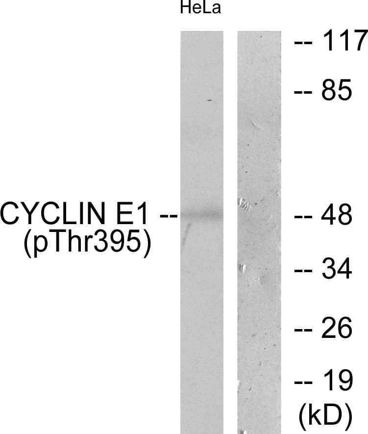CCNE1 / Cyclin E1 Antibody (phospho-Thr395)