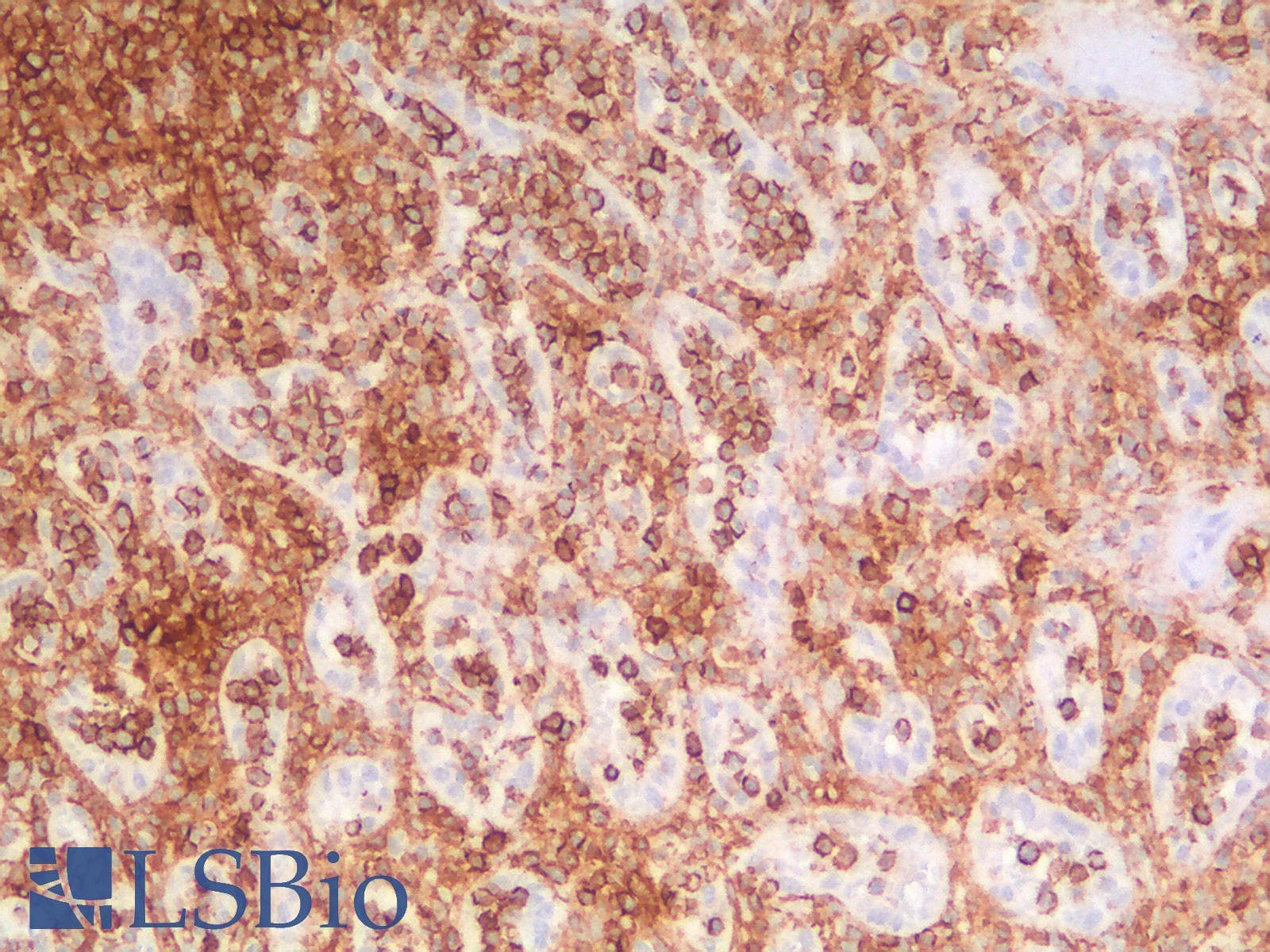 PathPlus™ CD44 Antibody (clone HCAM/2875R)