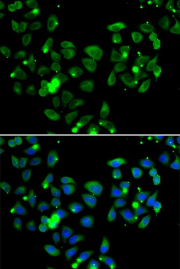 CARMA1 / CARD11 Antibody
