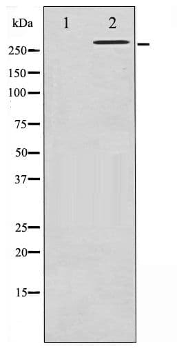 Polyclonal Rabbit anti-Human FLNA / Filamin A Antibody (phospho-Ser2152, IHC, WB)