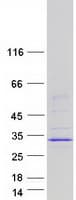 Human MBD3L2 Protein (Recombinant Myc-DDK (Flag))