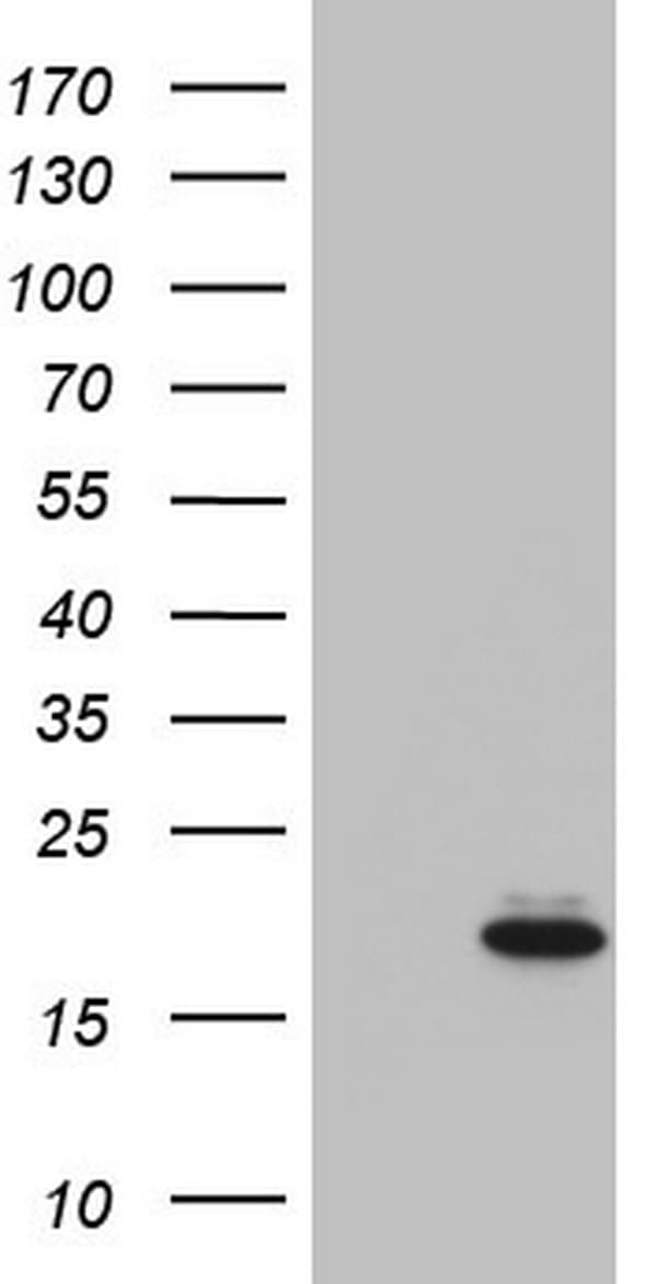 IGF1 Antibody (aa1-151, clone OTI3A6)