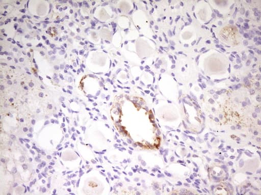 Monoclonal Mouse anti-Human MED15 / ARC105 Antibody (clone OTI1H5, aa393-679, IHC, WB)