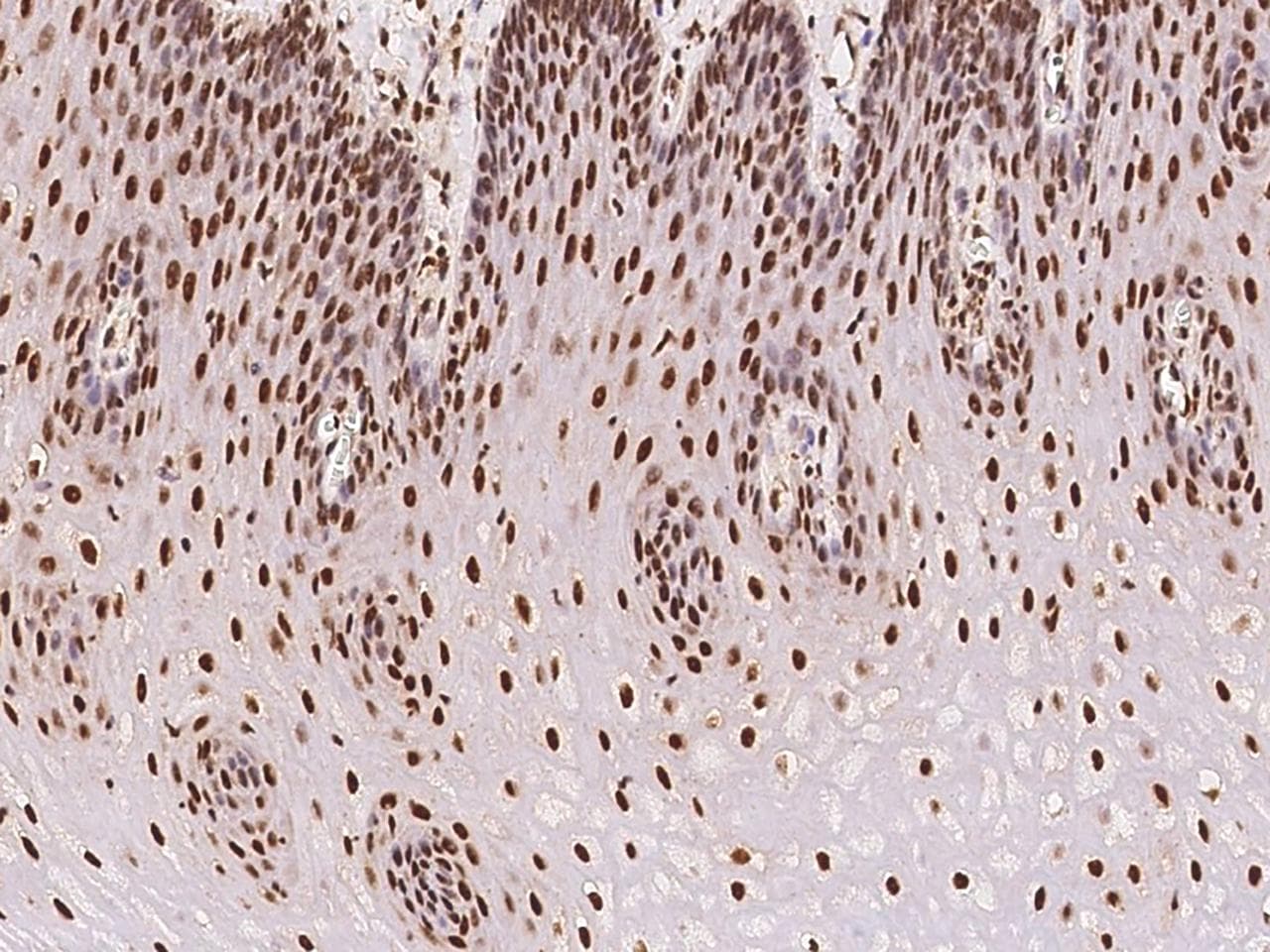 ARID1B / BAF250B Antibody
