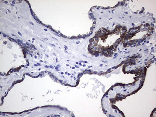 KRT19 / CK19 / Cytokeratin 19 Antibody (aa240-390, clone OTI8D1)