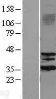 SIRT3 / Sirtuin 3 Protein (Over-Expression Lysate Myc-DDK (Flag))